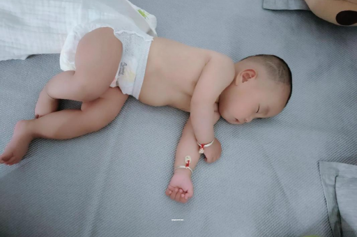 敦煌宝宝上火有眼屎